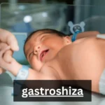 Understanding The Gastroshiza