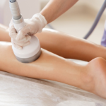 Understanding Cellulogia: Causes, Symptoms, Treatment, and Prevention Introduction